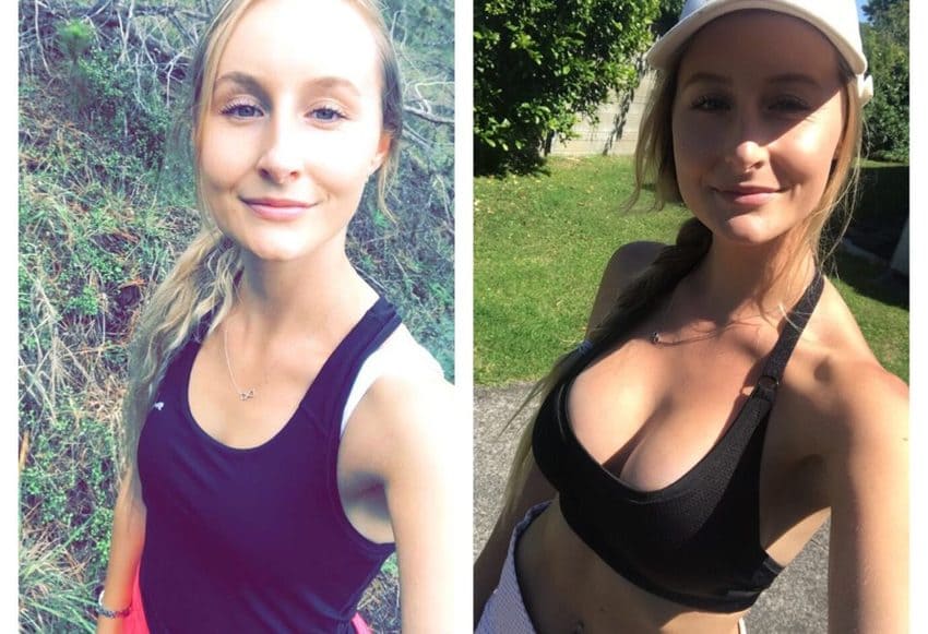 Zdjęcia przed i po powiększeniu piersi